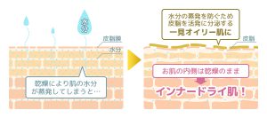 インナードライ